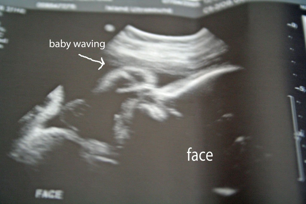 Waving Baby